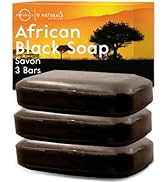O NATURALS Organic African Black Soap Bar 3PC - Rich in African Shea Butter - Helps Acne Prone Sk...