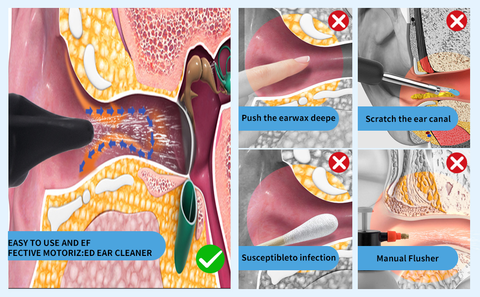 Electric Ear Wax Removal Kit