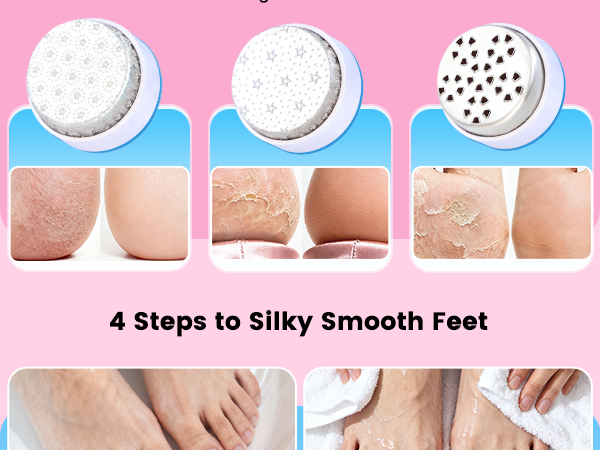 electric callus remover