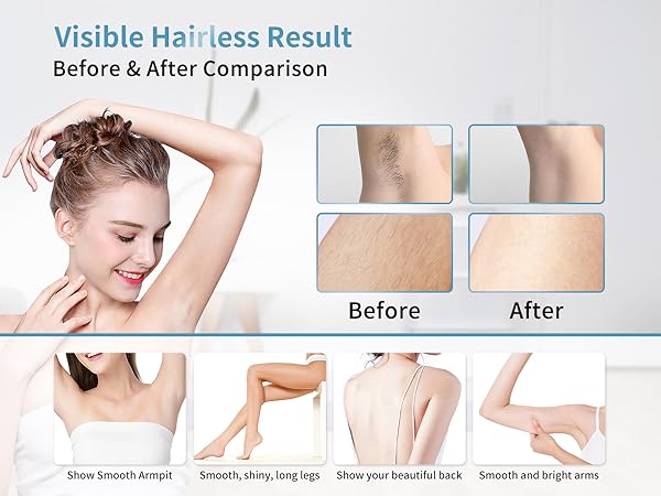 epilators hair removal for women