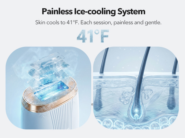 laser hair removal