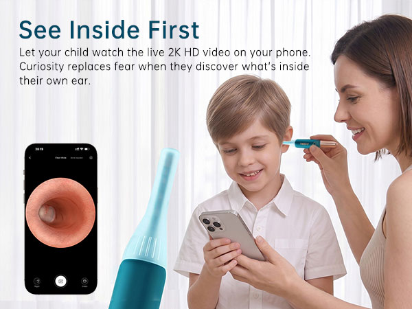 ear cleaning camera