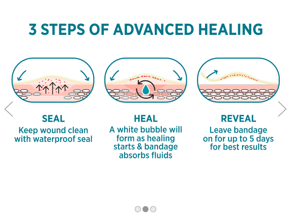 Advanced Healing with Hydrocolloid Bandages