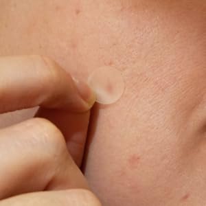 Absorbs spot secretions