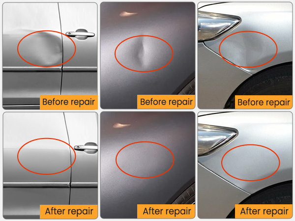 diy dent removal