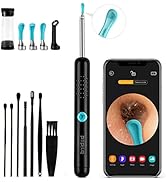 Ear Wax Removal Tool Camera - R1 Upgraded Anti-Fall Off Eartips Ear Cleaner with Camera, Wireless...