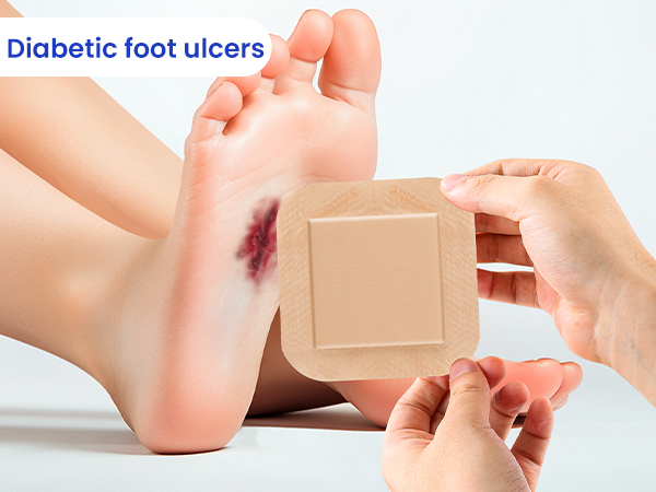 Silicone Foam Dressing