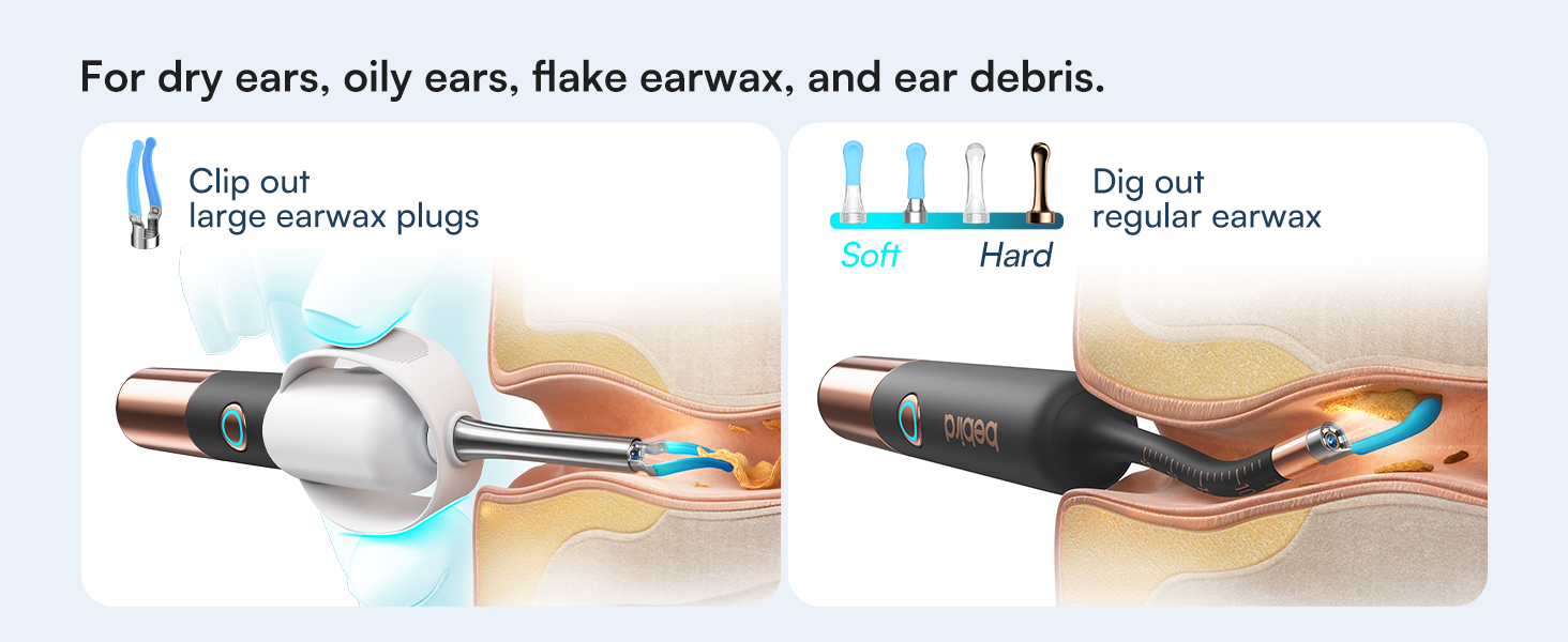 For dry ears, oily ears, flake earwax, and ear debris.