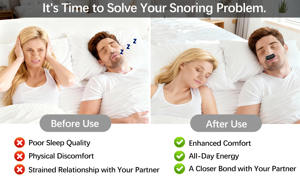 Anti Snoring Devices