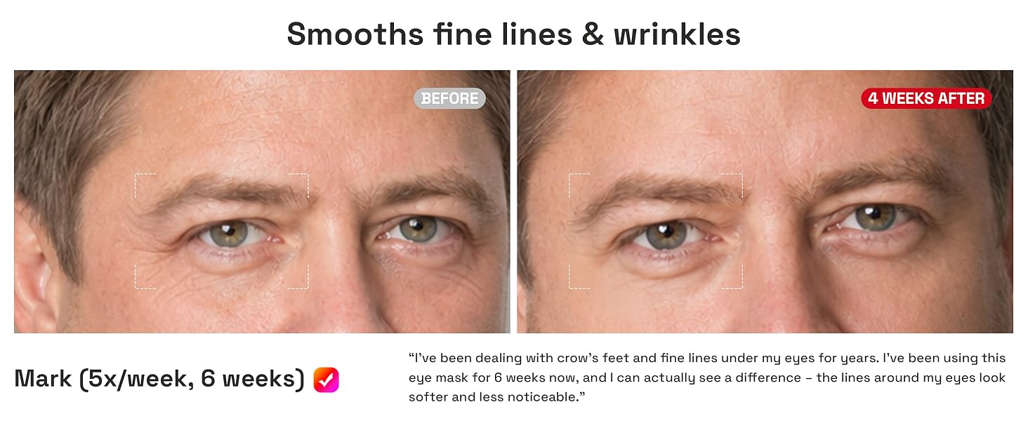 Smooths fine lines and wrinkles