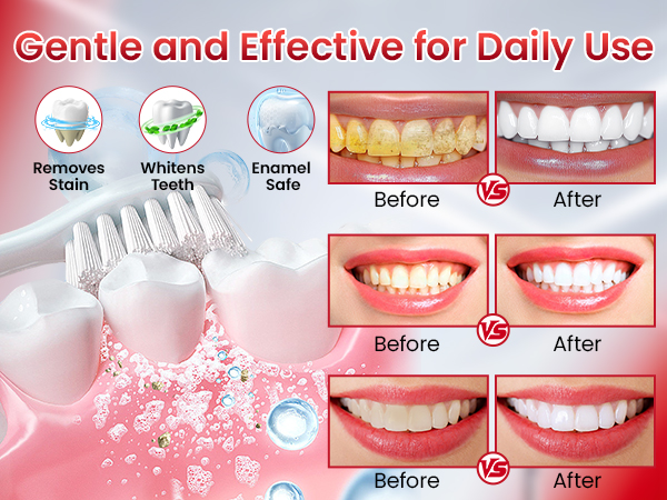 SP-6 Probiotic Brightening Toothpaste sp6 probiotic toothpaste whitening sp-6 probiotics whitening