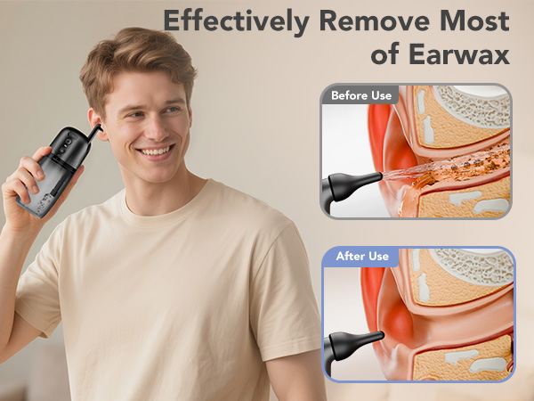 ear wax removal kit