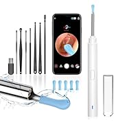 Ear Wax Removal, Ear Cleaner with Camera, Ears Wax Removal Kit with 1296P HD Ear Otoscope with 6 ...