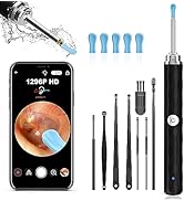 Ear Wax Removal, Ear Cleaner with Camera and Light, Ear Wax Removal Kit with 1296P Otoscope, Ear ...