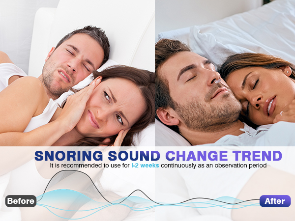 Snore Stopper
