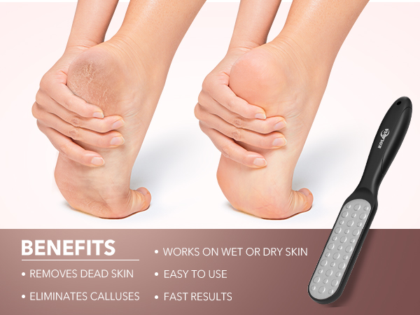Foot Rasp