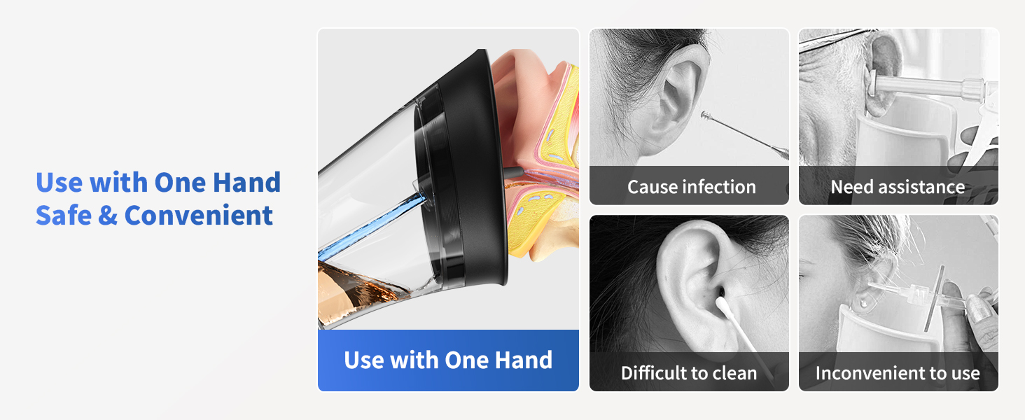 ear wax removal