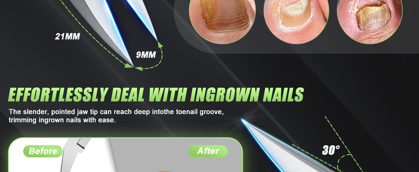 toenail clippers