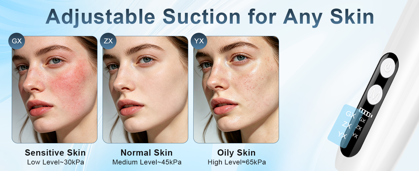 black head remover for face