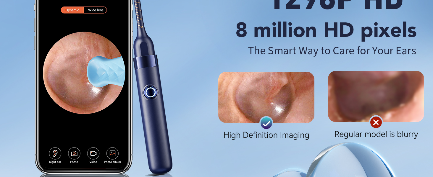 ear camera wax removal