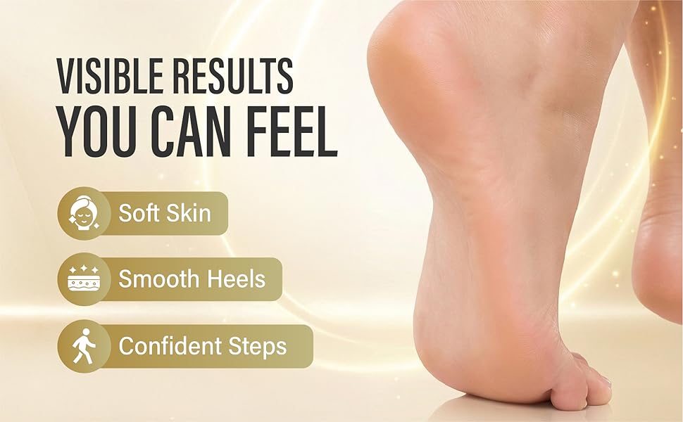 foot callus remover