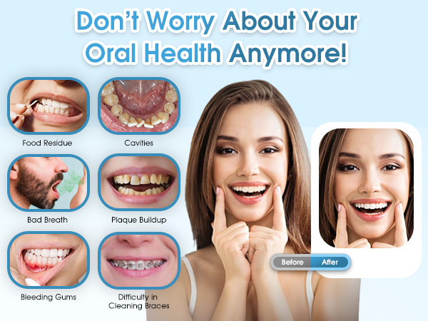 dental water flosser