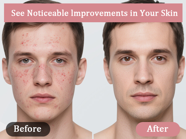 face massager electric face lifting