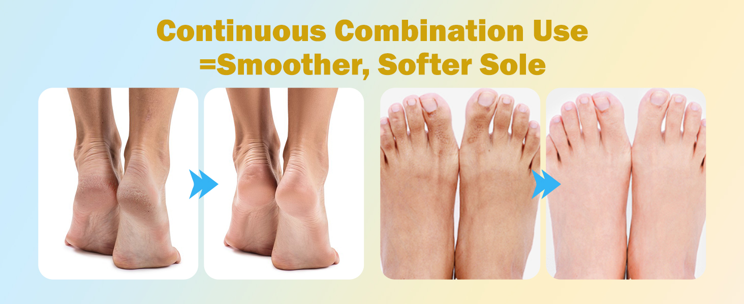 Foot Mask
