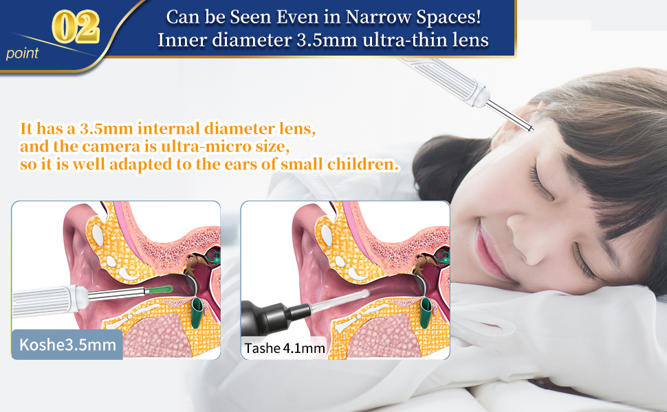 ear wax removal camera