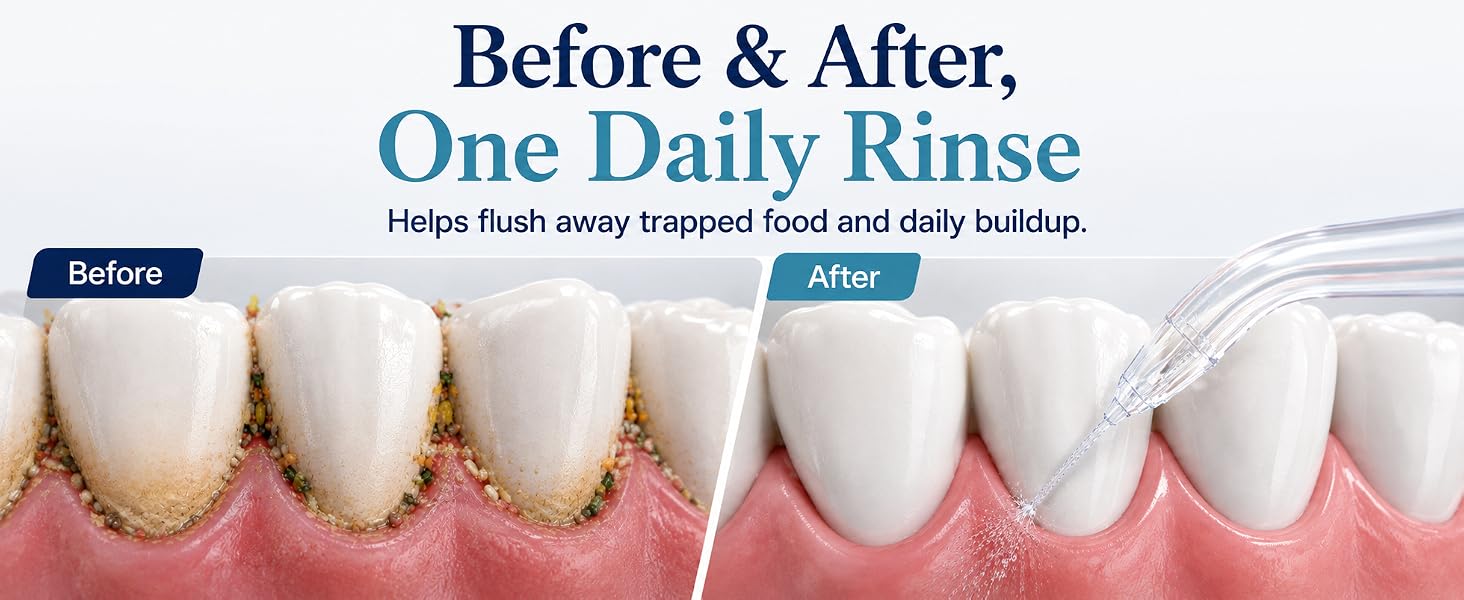 travel water flosser