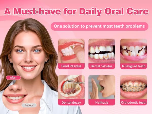 Pink Tovendor electric water flosser helps keep teeth and oral health