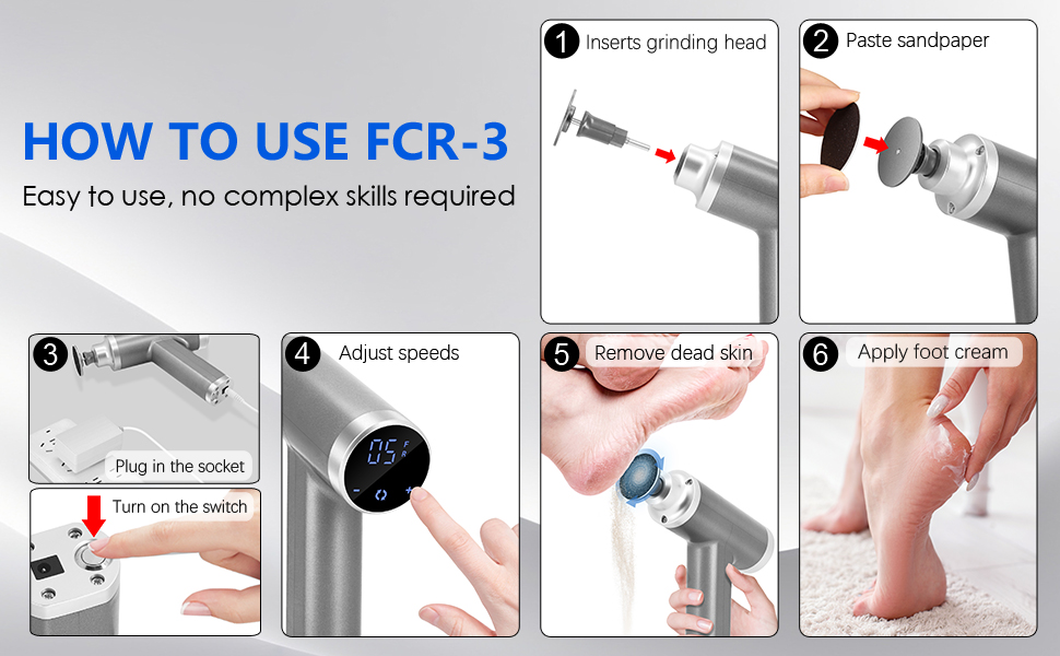 electric callus remover