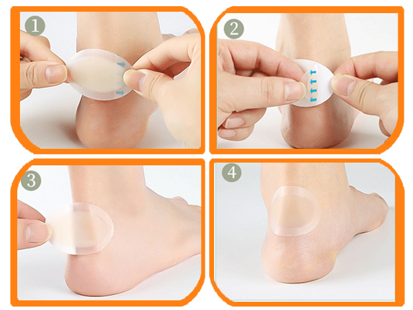 Hydrocolloid Blister Bandages 