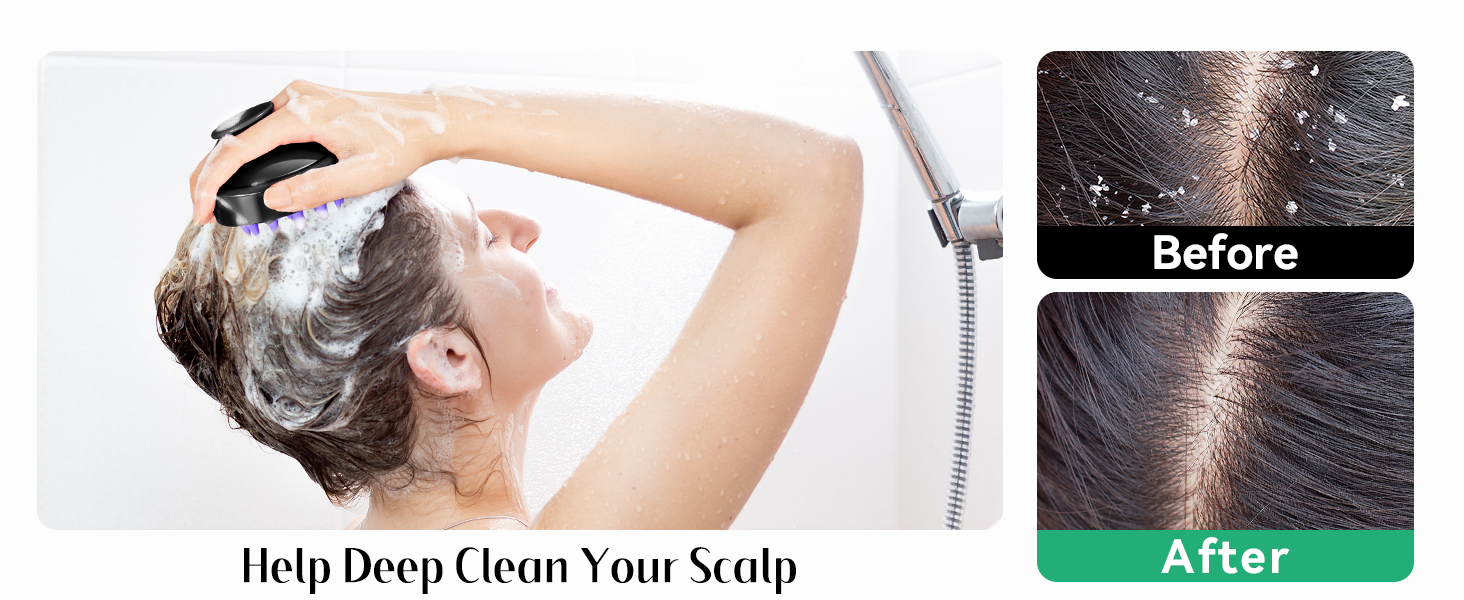 scalp scrubber