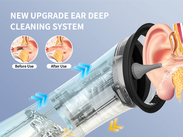 earwax removal kit