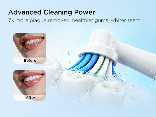 electric toothbrushes
