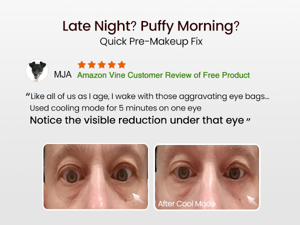 red light therapy for face