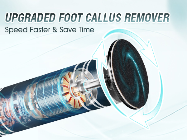 foot callus remover