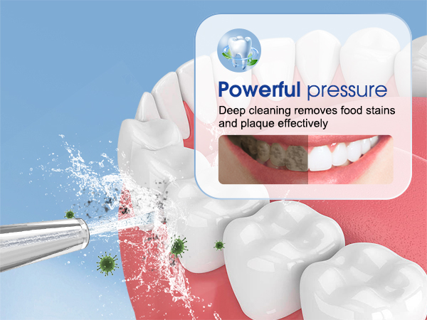 hilo dental de agua powerful pressure