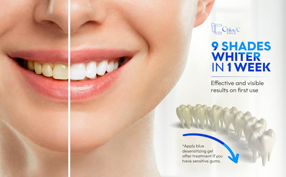 teeth whitening results, before and after, whiter teeth in a week, shade guide, visible whitening