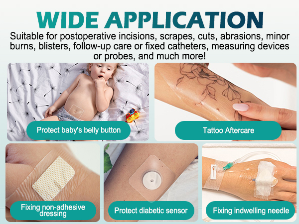 Transparent Film Dressing