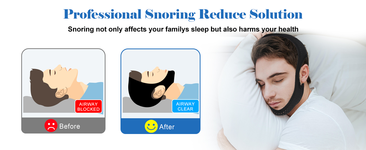 anti snoring devices
