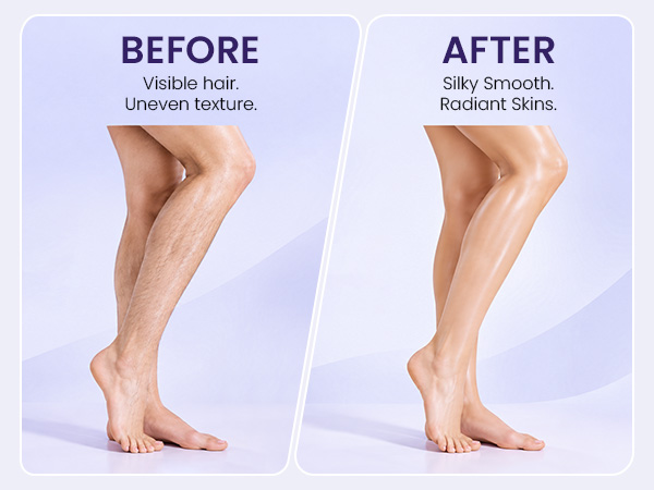 Smooth leg shaver