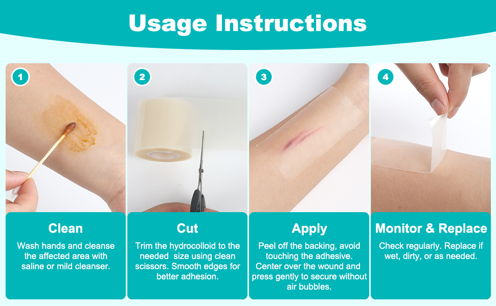 hydrocolloid bandages-hydrocolloid roll