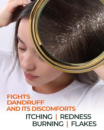 FIGHTS DANDRUFF AND ITS DISCOMFORTS ITCHING | REDNESS | BURNING | FLAKES