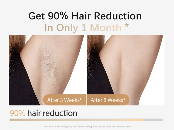 at home laser hair removal