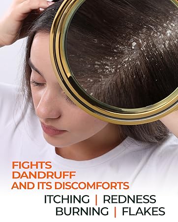 FIGHTS DANDRUFF AND ITS DISCOMFORTS ITCHING | REDNESS | BURNING | FLAKES