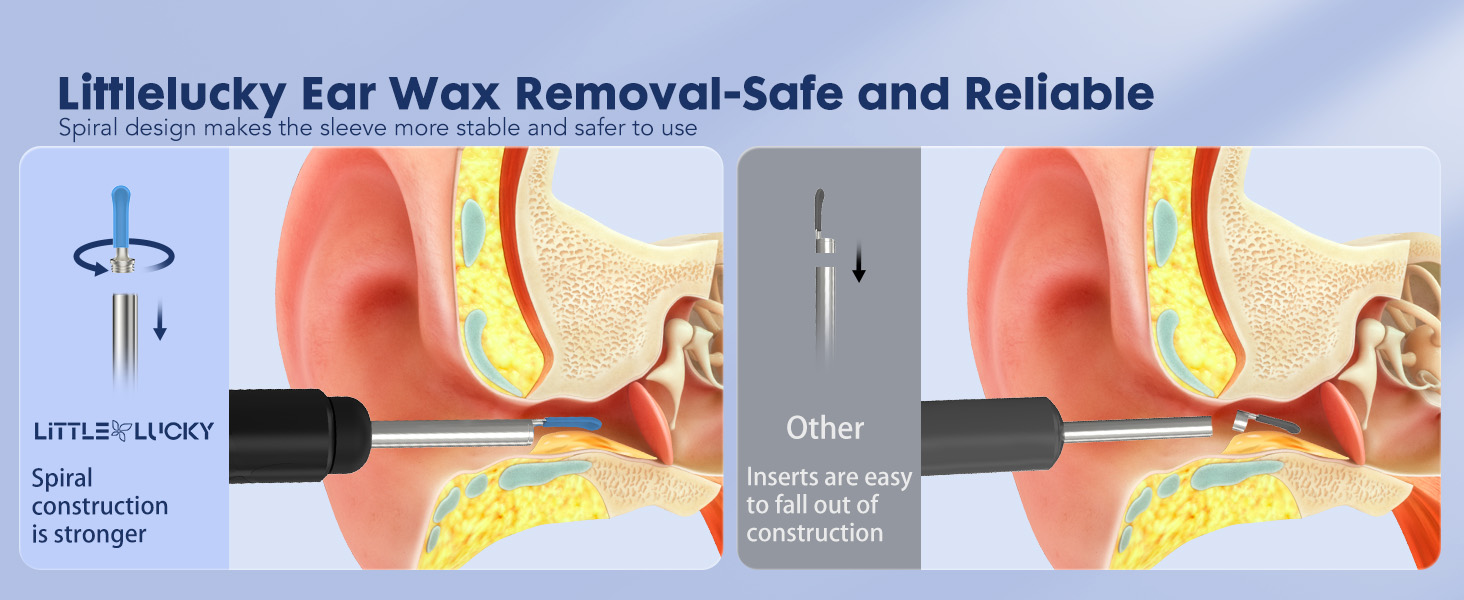 ear wax removal tool camera