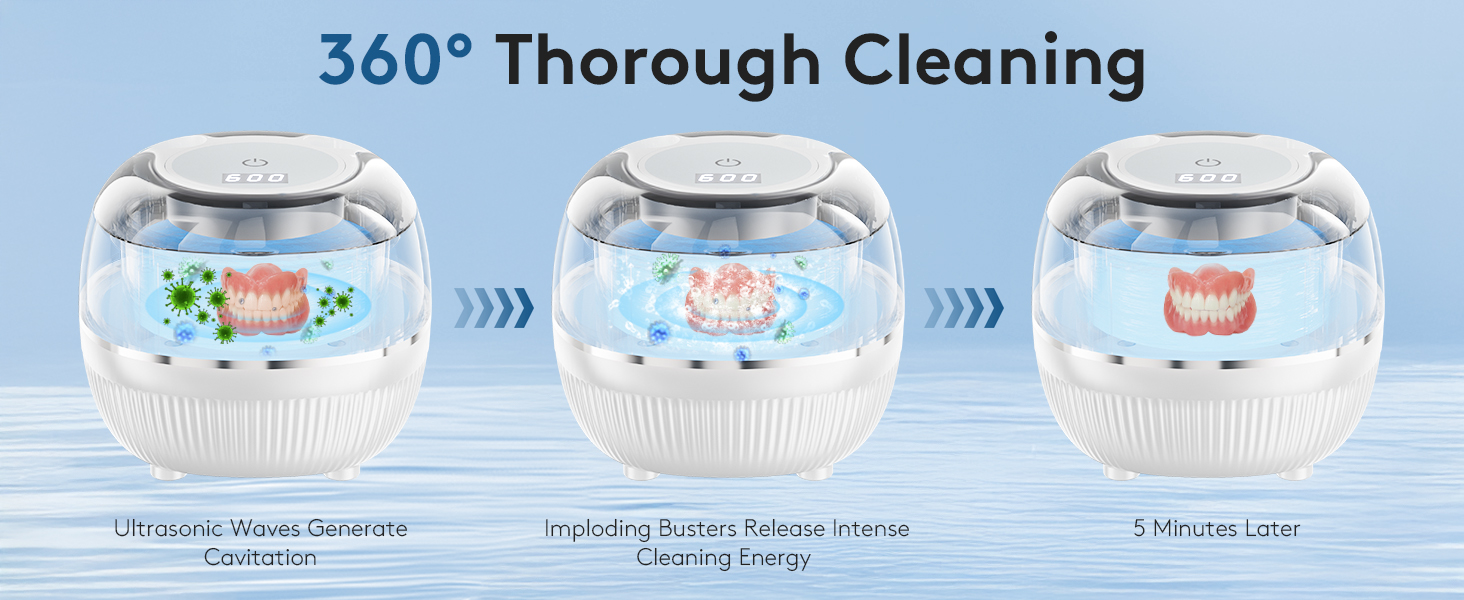 ultrasonic retainer cleaner