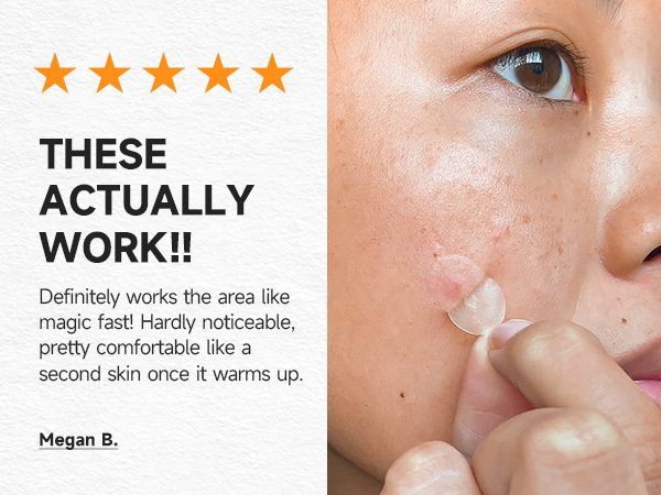 pimple patches